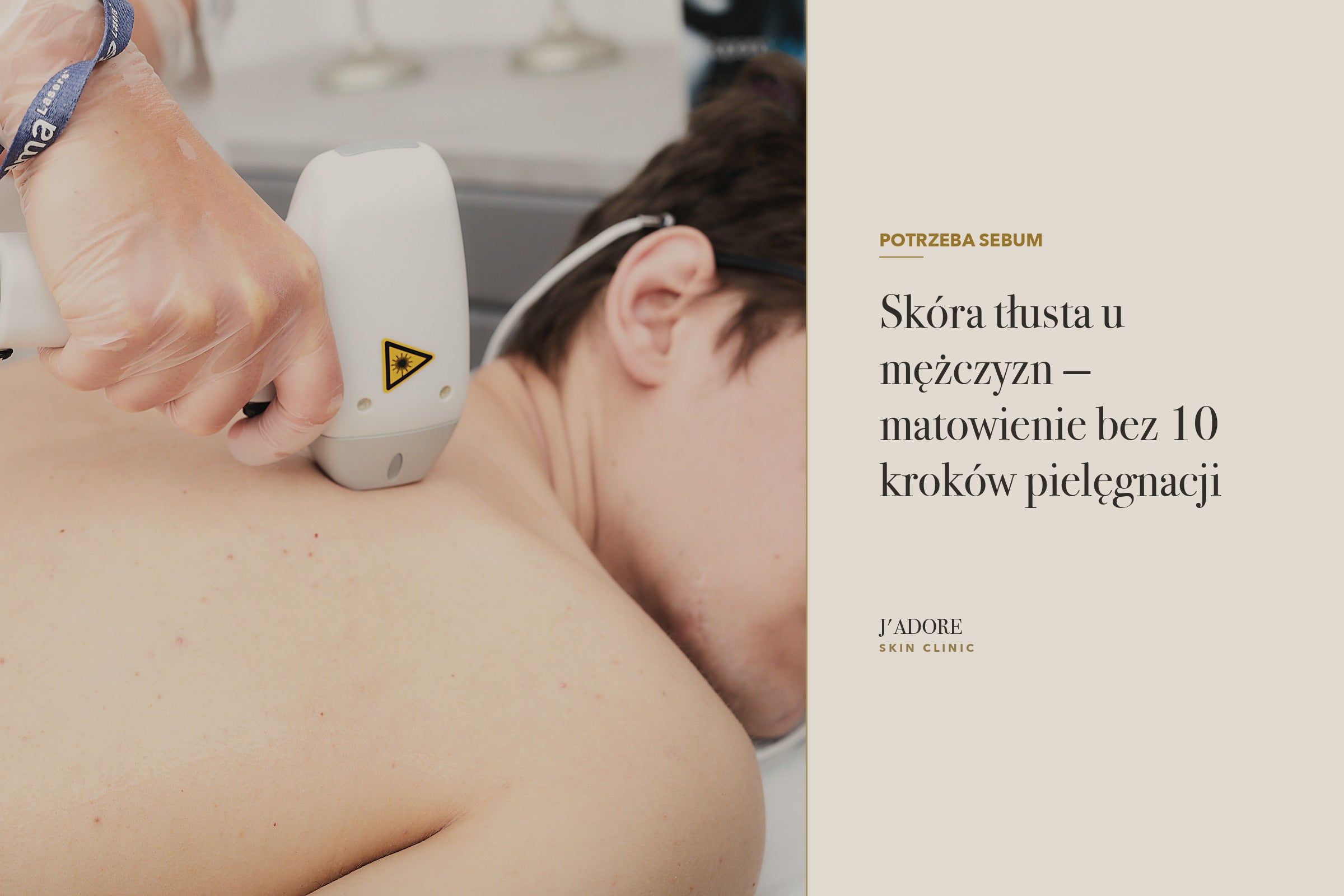 Skóra tłusta u mężczyzn — matowienie bez 10 kroków pielęgnacji