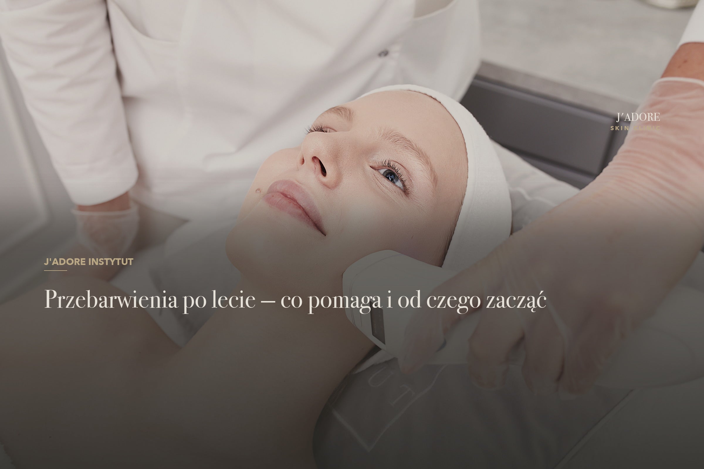 Przebarwienia po lecie — co pomaga i od czego zacząć