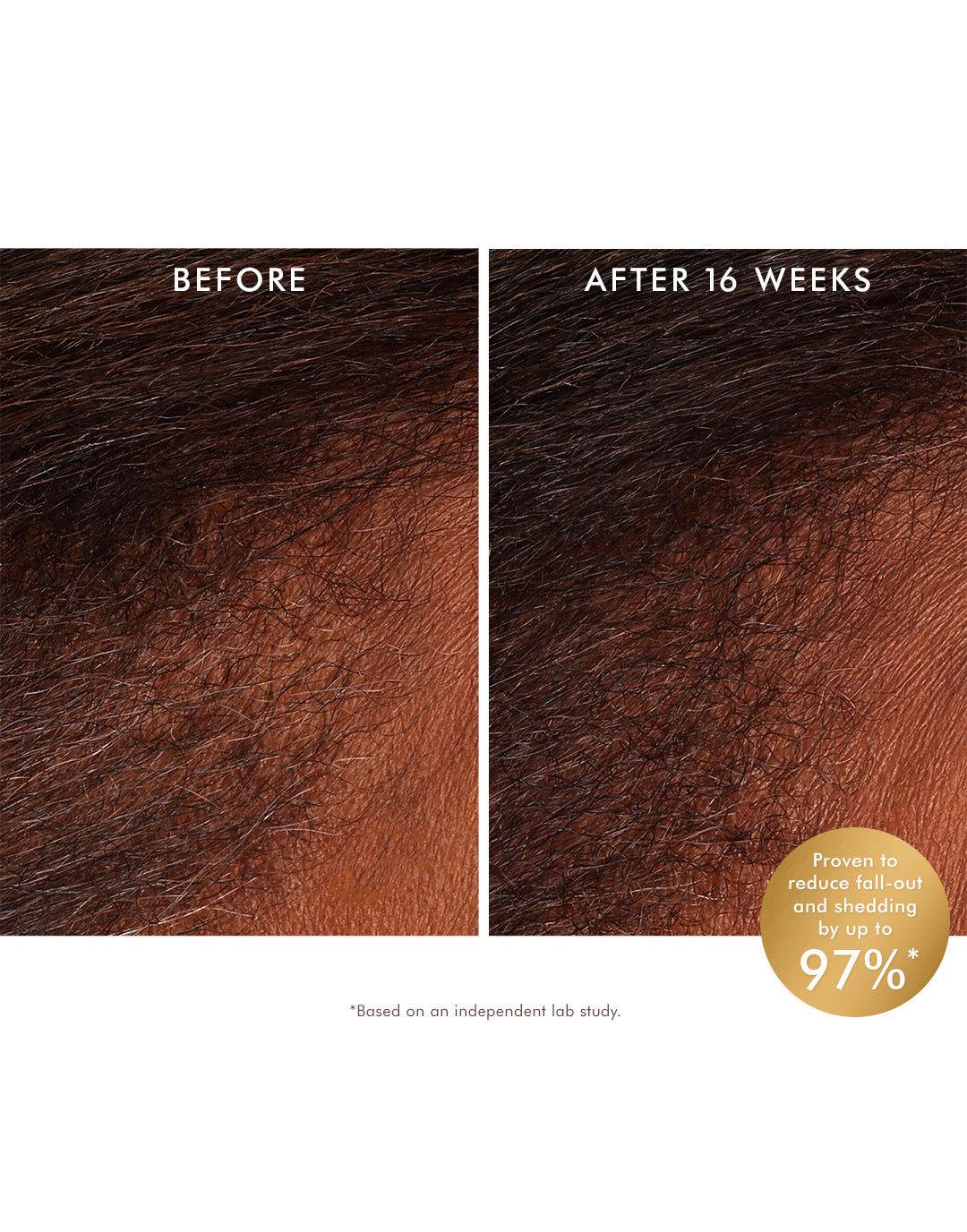 Revitalizing Scalp Tonic – Moroccanoil