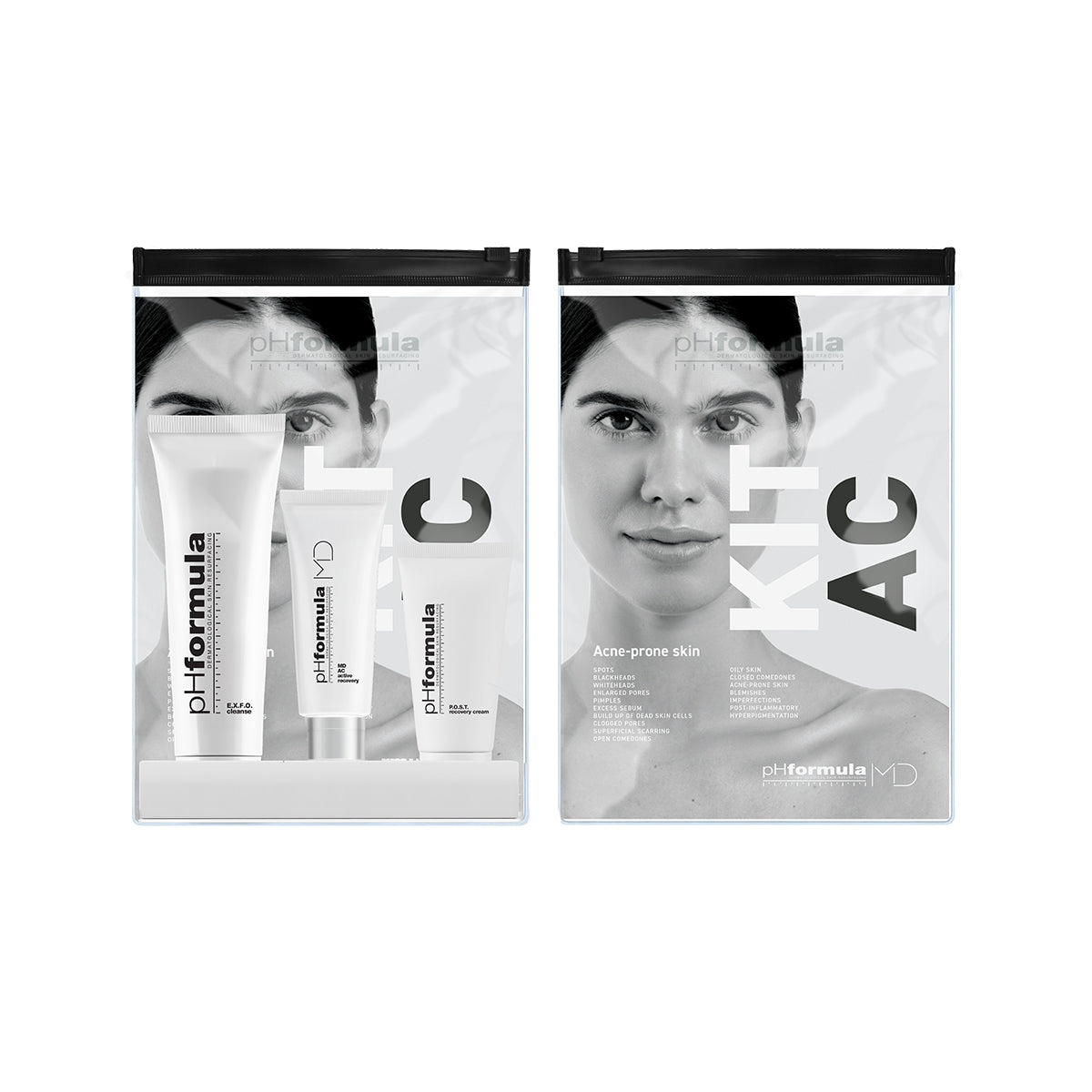 pHformula MD A.C. resurfacing kit — zdjęcie 3