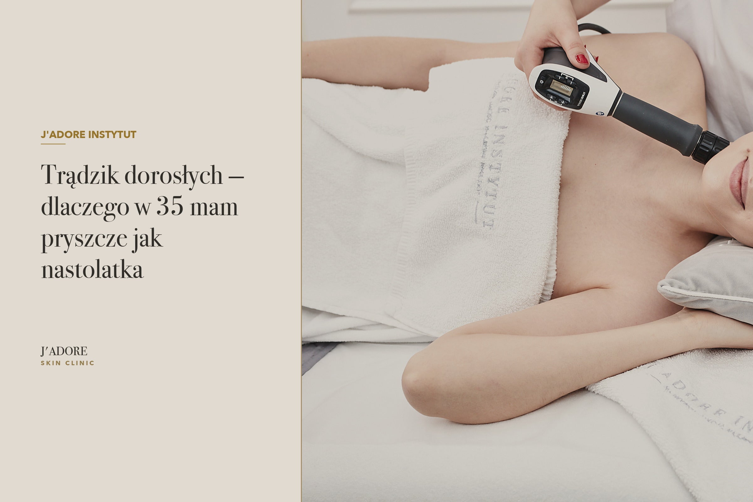 Trądzik dorosłych — dlaczego w 35 mam pryszcze jak nastolatka