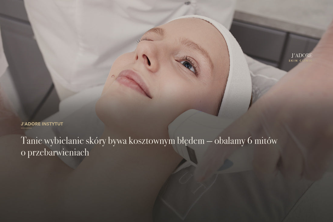 Tanie wybielanie skóry bywa kosztownym błędem — obalamy 6 mitów o przebarwieniach