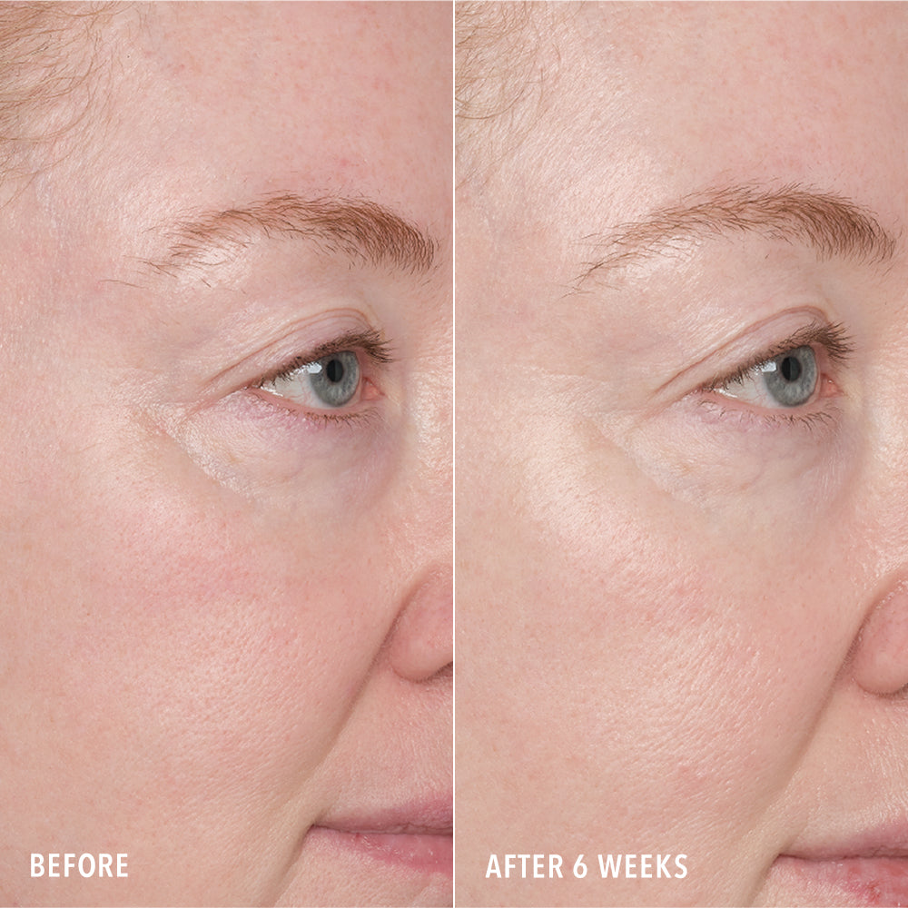 HydroPeptide Resurface & Repair Peptide Pads — HydroPeptide
