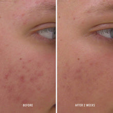 HydroPeptide Clear Rescue Serum 30 ml — foto 3