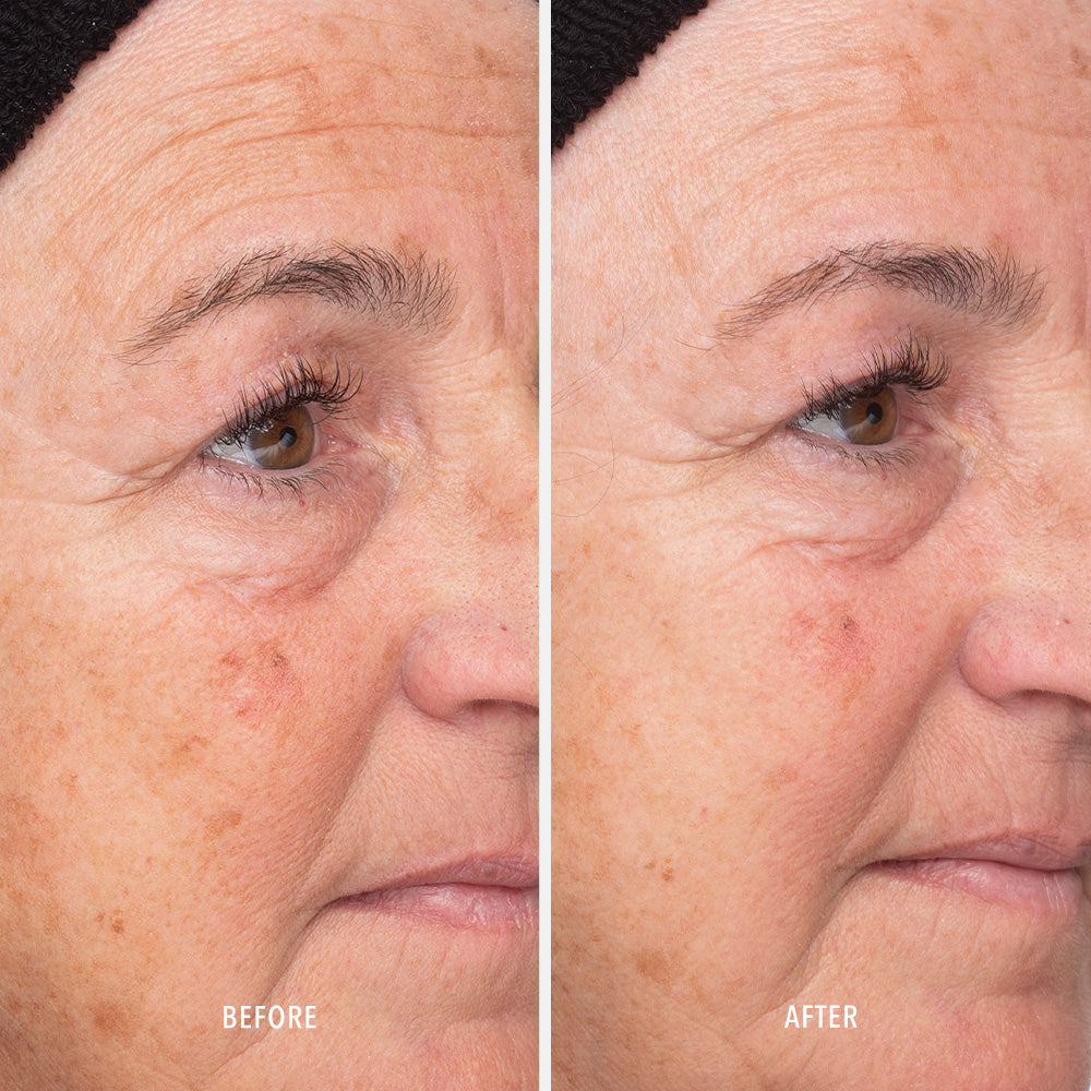 HydroPeptide Liquid Resurfacing Solution — HydroPeptide