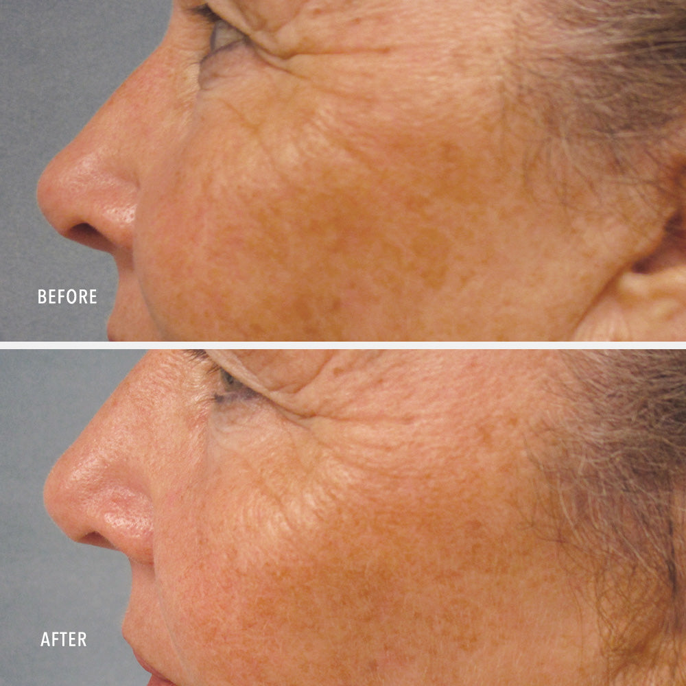 HydroPeptide LumaPro-C Face Serum — HydroPeptide