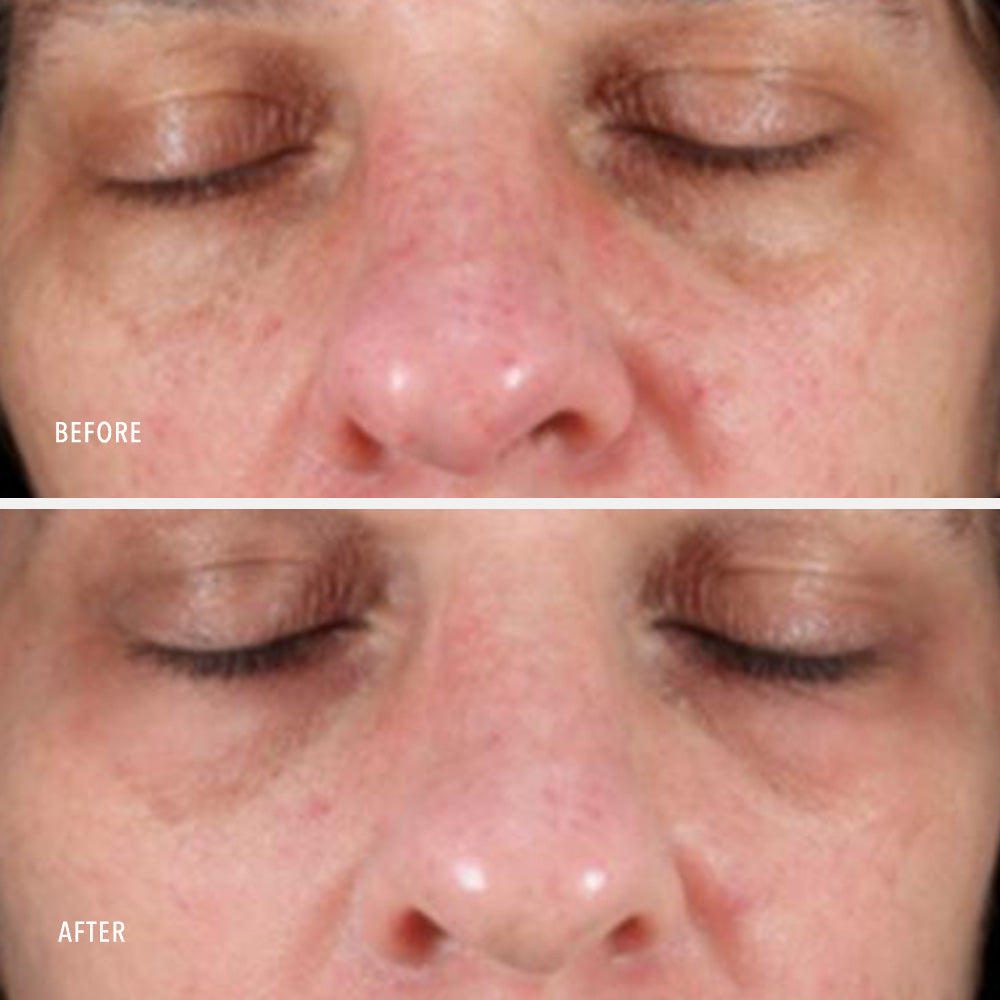HydroPeptide Collagen ReActivate PM — HydroPeptide