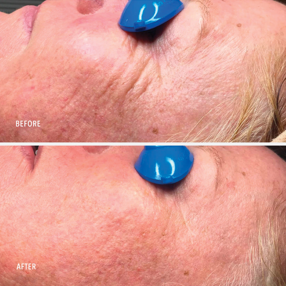 HydroPeptide Collagen ReActivate PM 5 ml — HydroPeptide