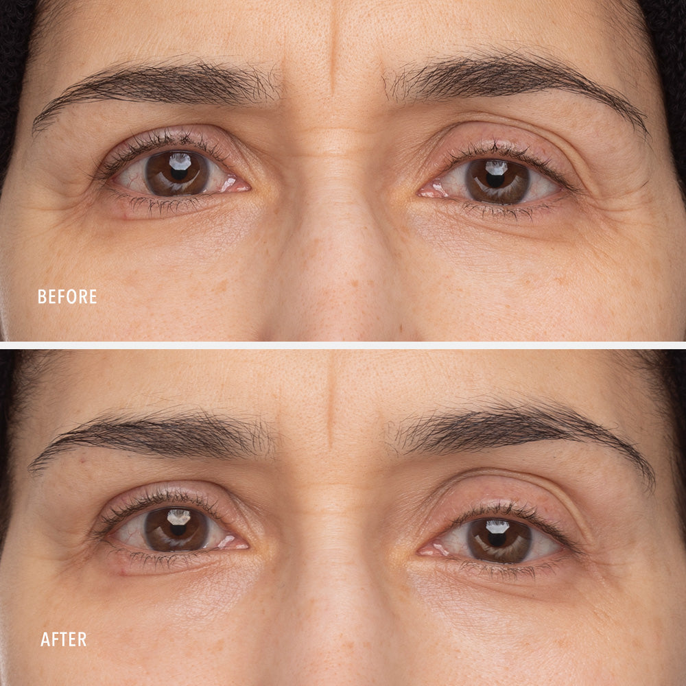 HydroPeptide Retinol Eye Renewal 15 ml — HydroPeptide