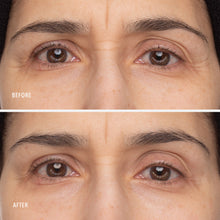 HydroPeptide Retinol Eye Renewal 15 ml — Foto 5
