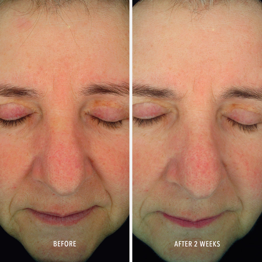 HydroPeptide Soothing Serum — HydroPeptide