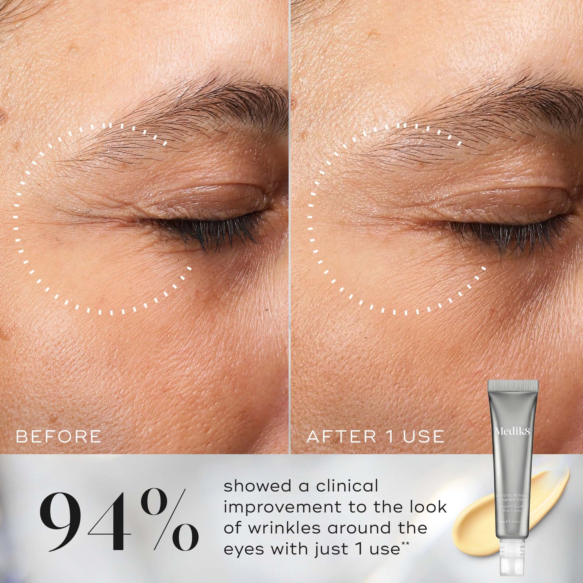 Crystal Retinal® Ceramide Eye – 3