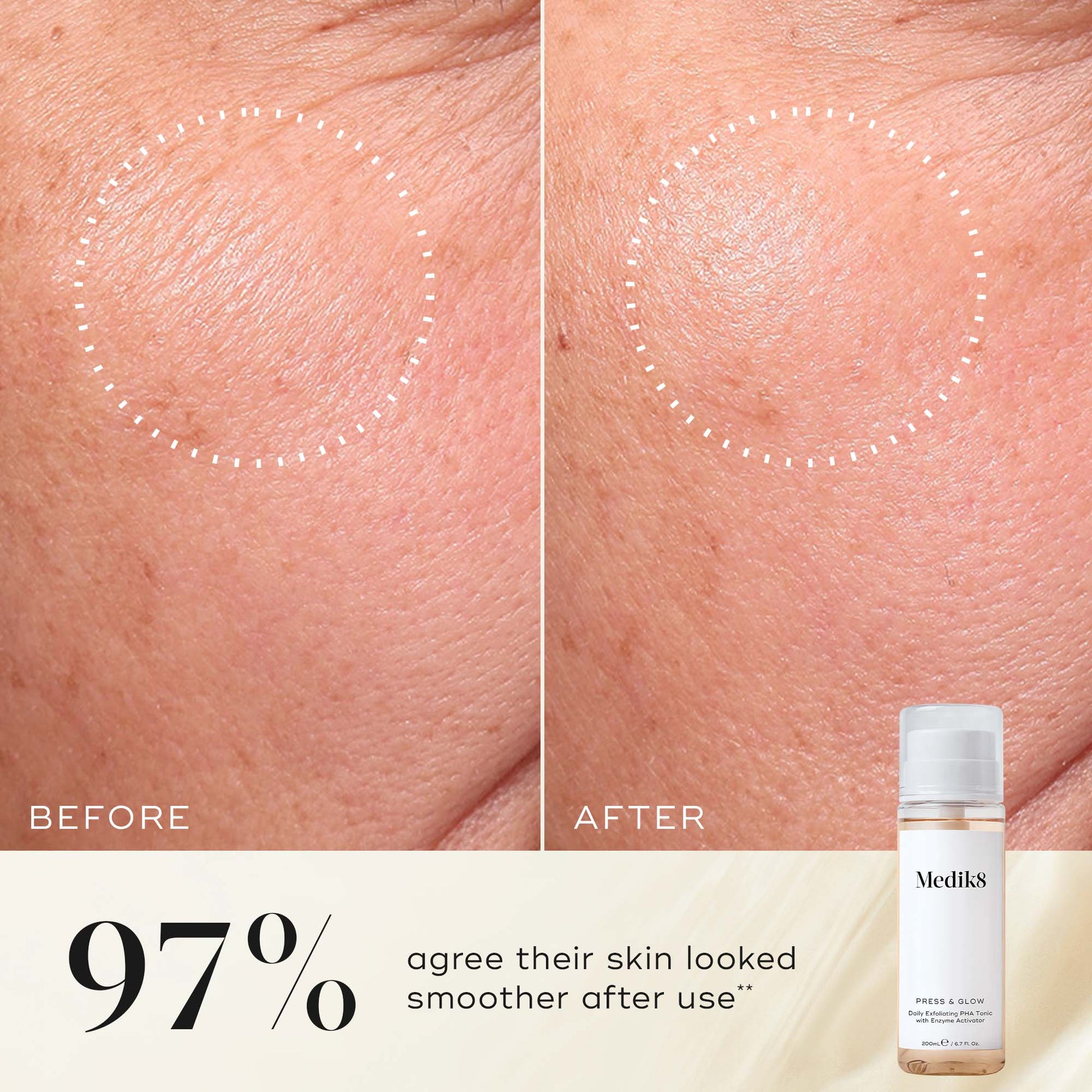 Press & Glow® – 4