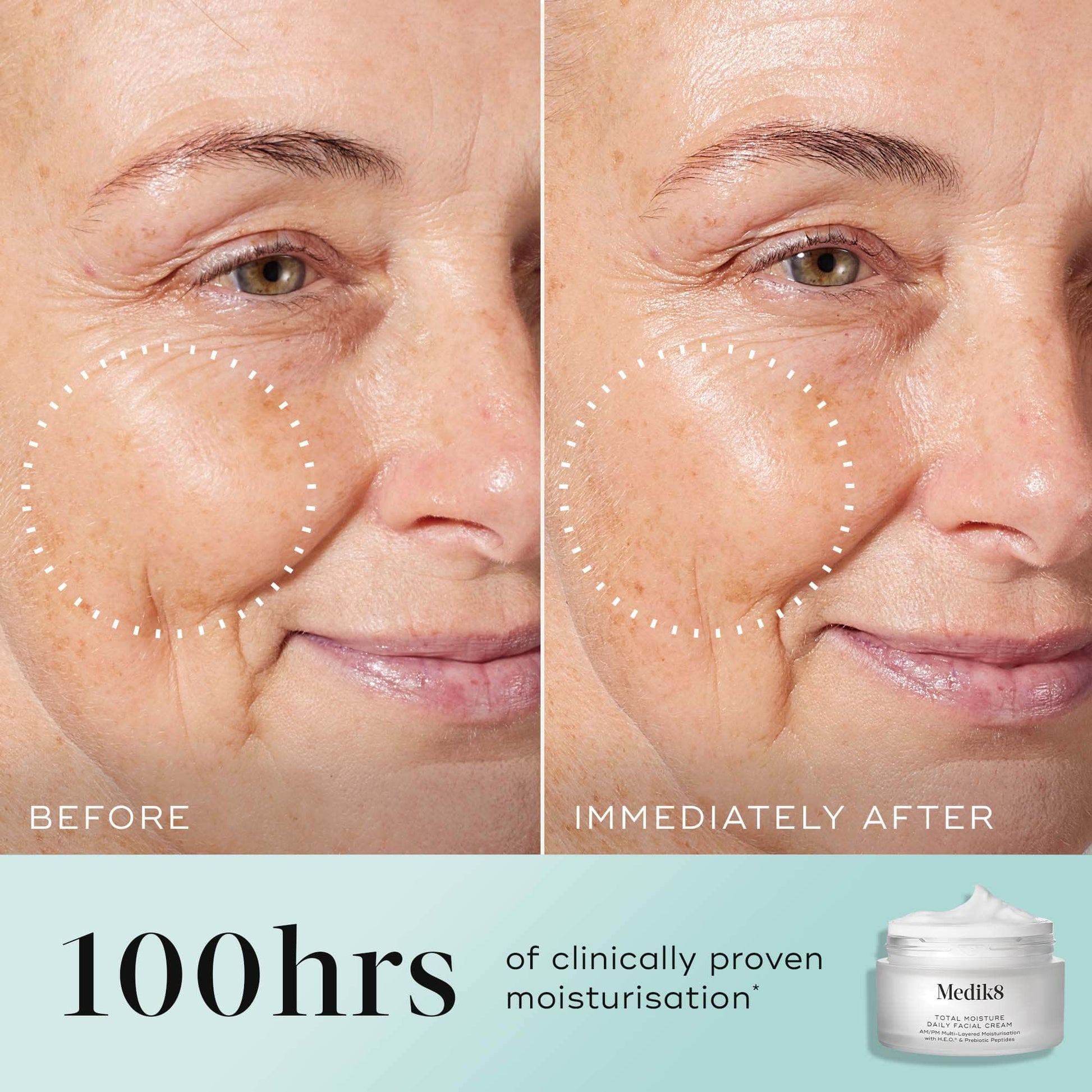 Total Moisture Daily Facial Cream™ – 4