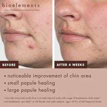 Bioelements Spot Defy 15 ml — zdjęcie 5