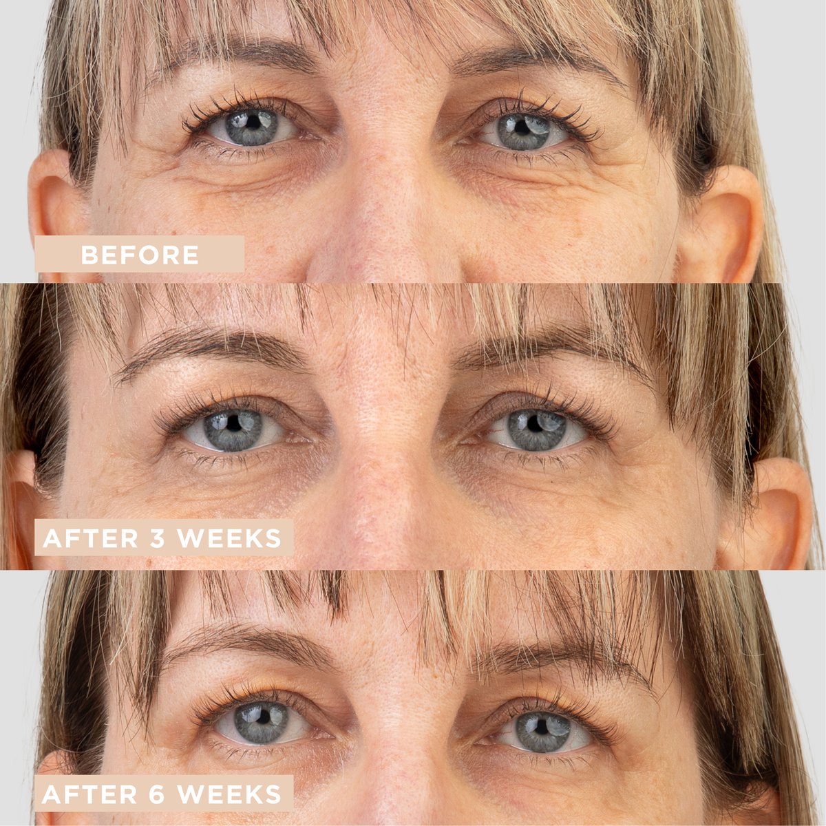 LyconSkin Eye Lifting Gel-Crème Serum pod oczy 15 ml — zdjęcie 5