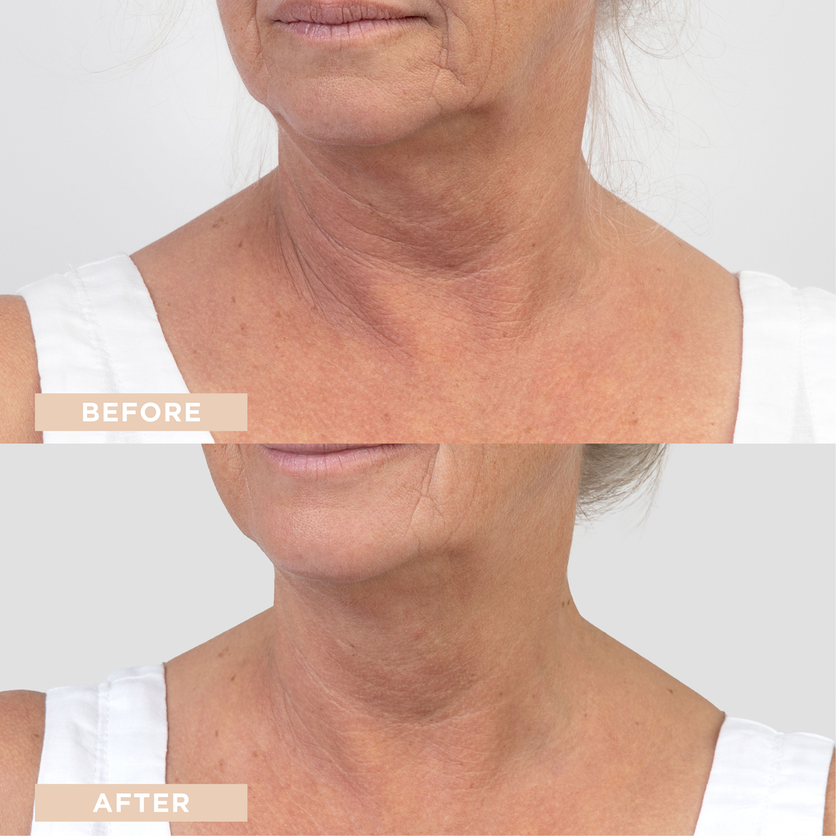LyconSkin Revitalising Hyaluronic + B5 Booster Serum 30 ml — zdjęcie 5