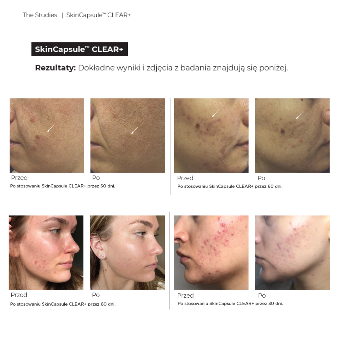 Hush & Hush SkinCapsule CLEAR+
