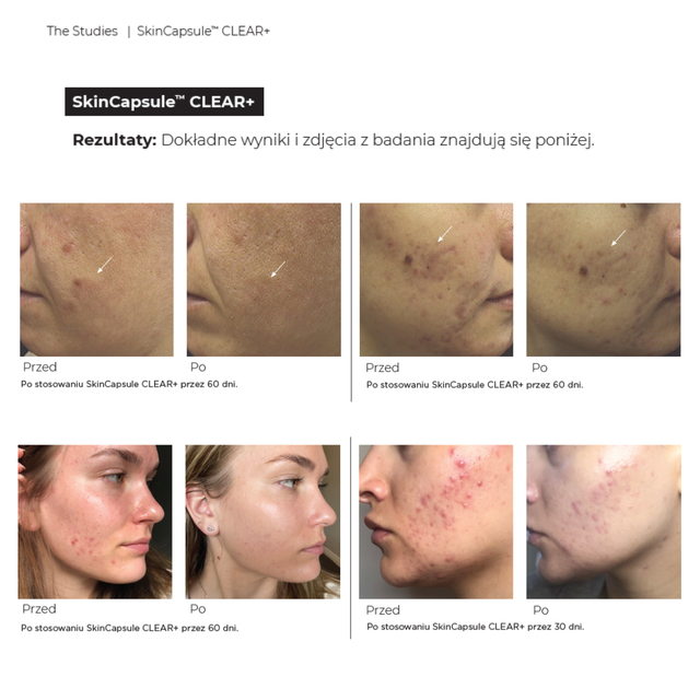 Hush & Hush SkinCapsule CLEAR+