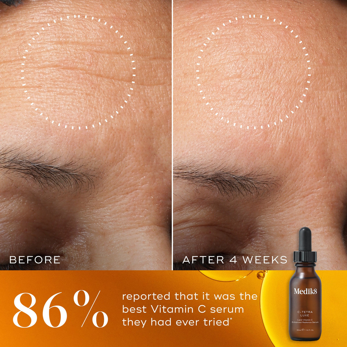 C-Tetra® Eye