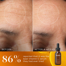 C-Tetra® Eye — zdjęcie 4