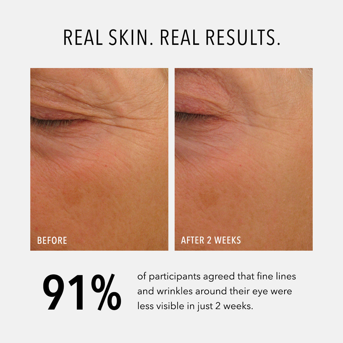 HydroPeptide Eye Authority — HydroPeptide