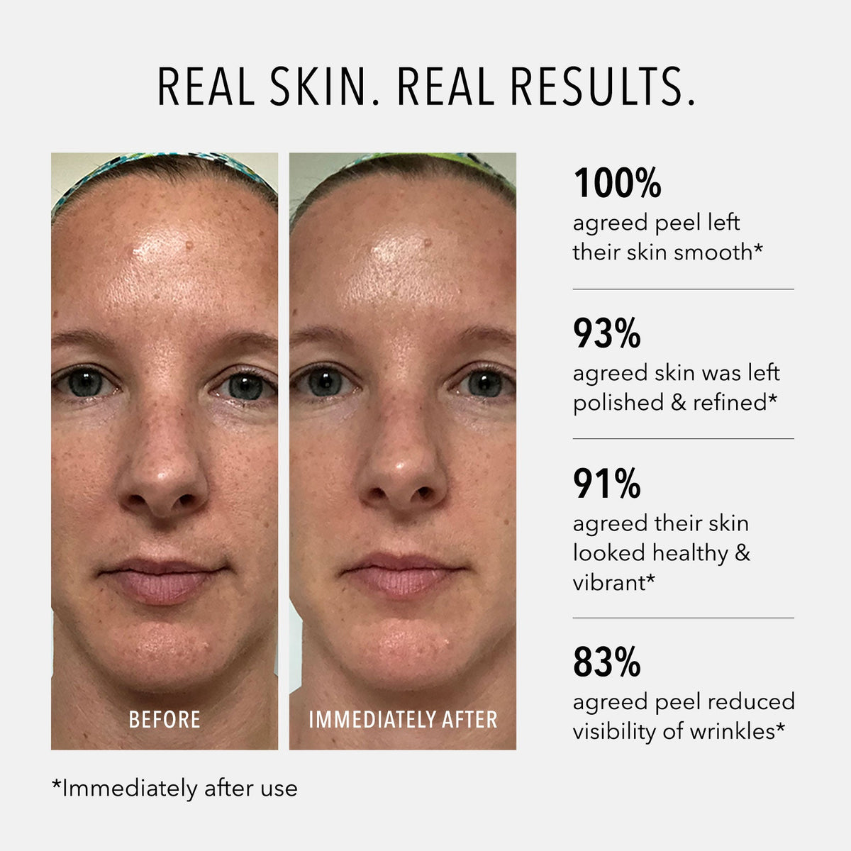 HydroPeptide Polish & Plump Face Peel — HydroPeptide