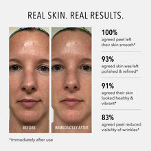 HydroPeptide Polish & Plump Face Peel 50 ml — foto 3