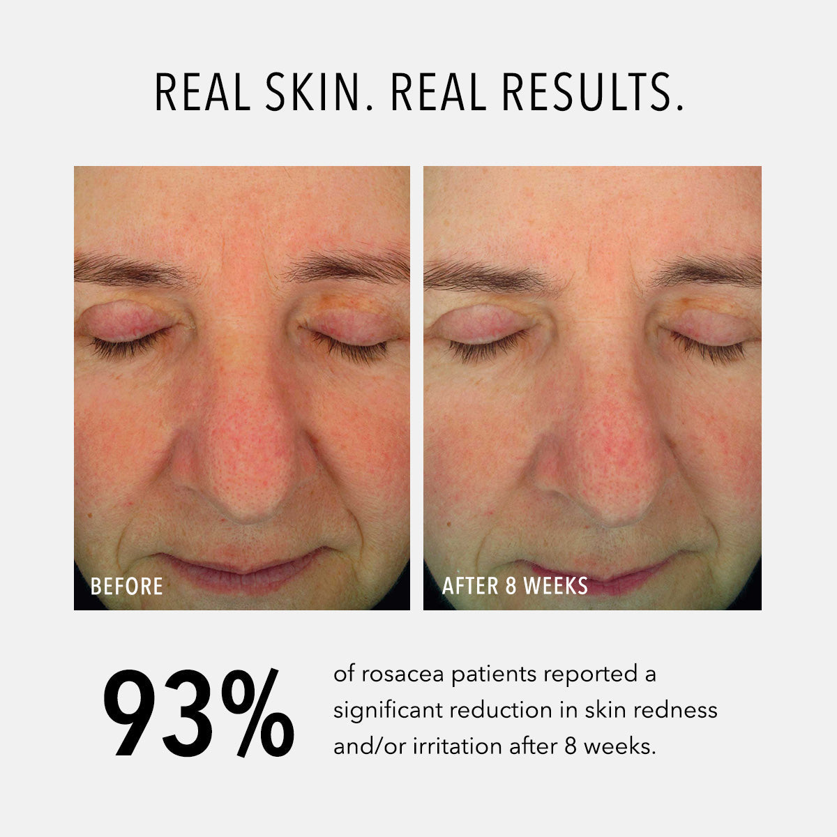 HydroPeptide Soothing Serum — HydroPeptide