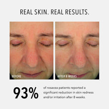 HydroPeptide Soothing Serum 30 ml — foto 3