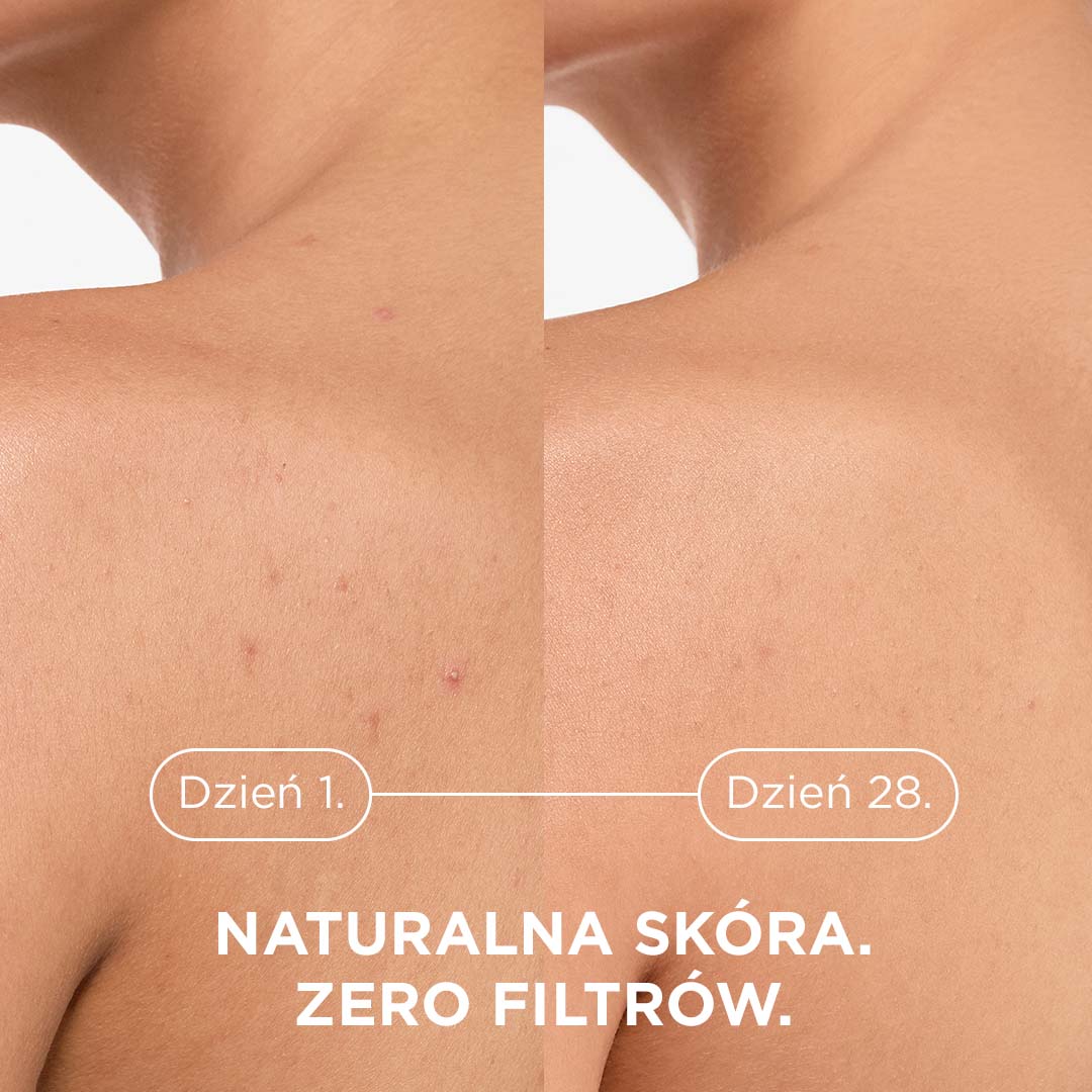 Bioderma Sébium Kerato+ body 150 ml — zdjęcie 3