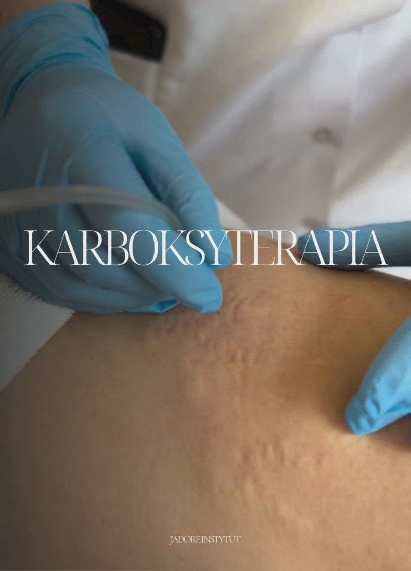 Załaduj wideo: KARBOKSYTERAPIA