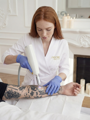 Q-Switch laserowe usuwanie tatuażu – zabieg w J'adore Instytut Kraków