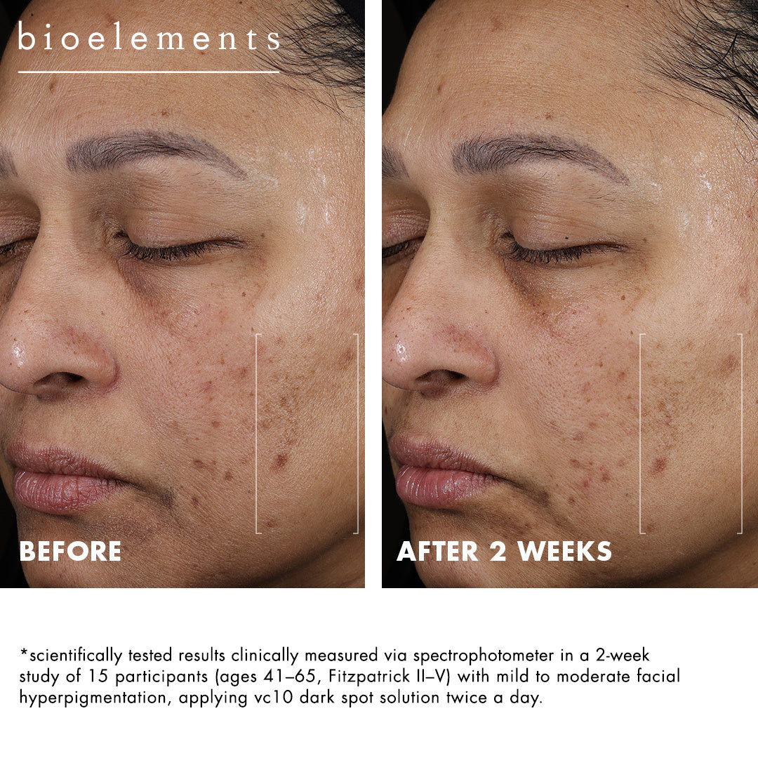 Bioelements VC10 Dark Spot Solution 15 ml — zdjęcie 3