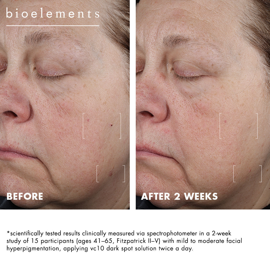 Bioelements VC10 Dark Spot Solution 15 ml — zdjęcie 4
