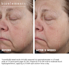 Bioelements VC10 Dark Spot Solution 15 ml — bilde 4